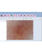 Software professionale per DERMATOSCOPIO Wi-Fi con filtro polarizzato (cod. DN34484)